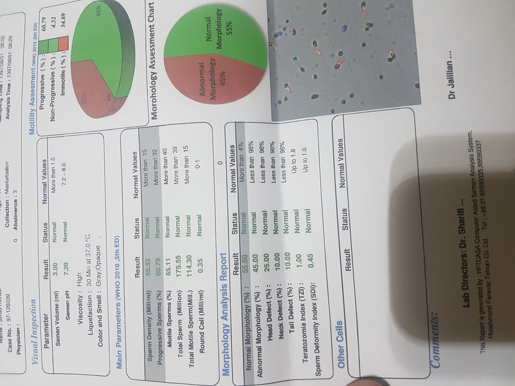 تحلیل نتیجه ازامایش برای بارداری