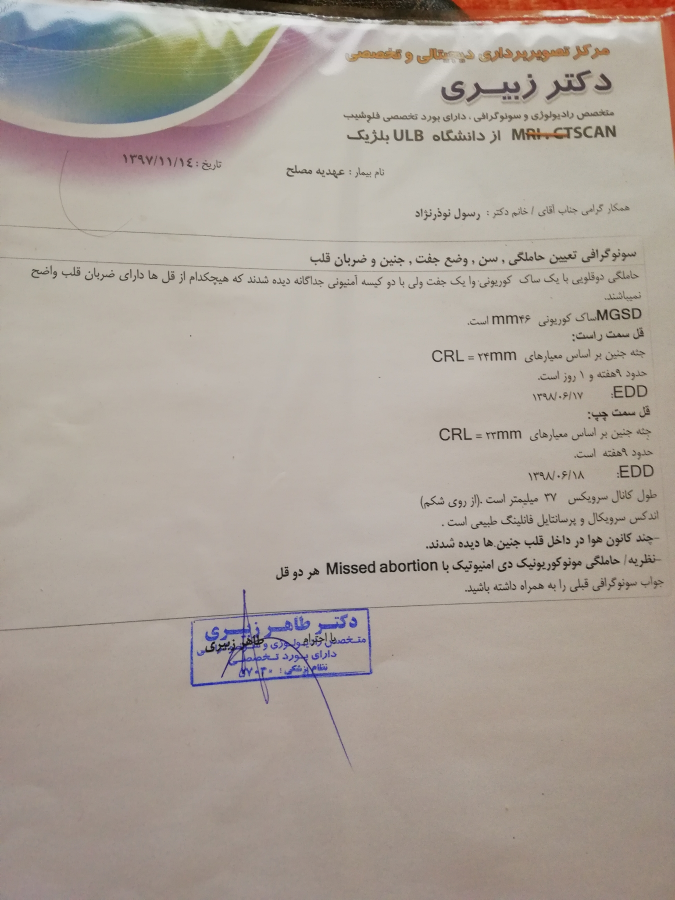 بارداری دوقلو دیابت سقط بارداری دوقلو دیابت سقط