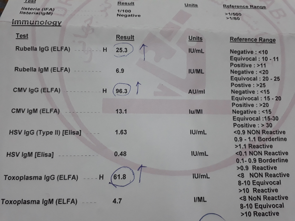 تفسیر ازمایش ژنتیک