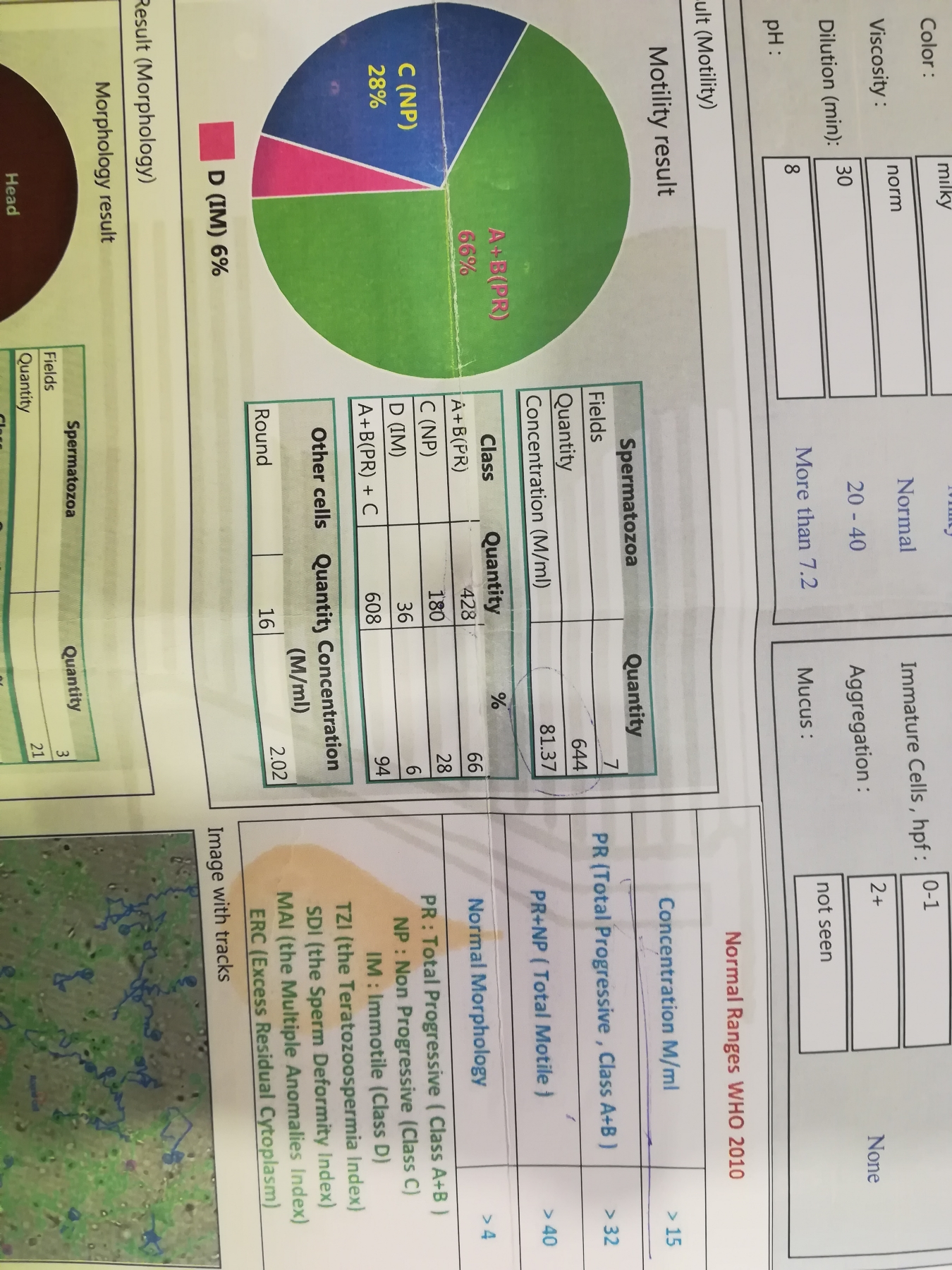 تفسیر ازمایش اسپرم