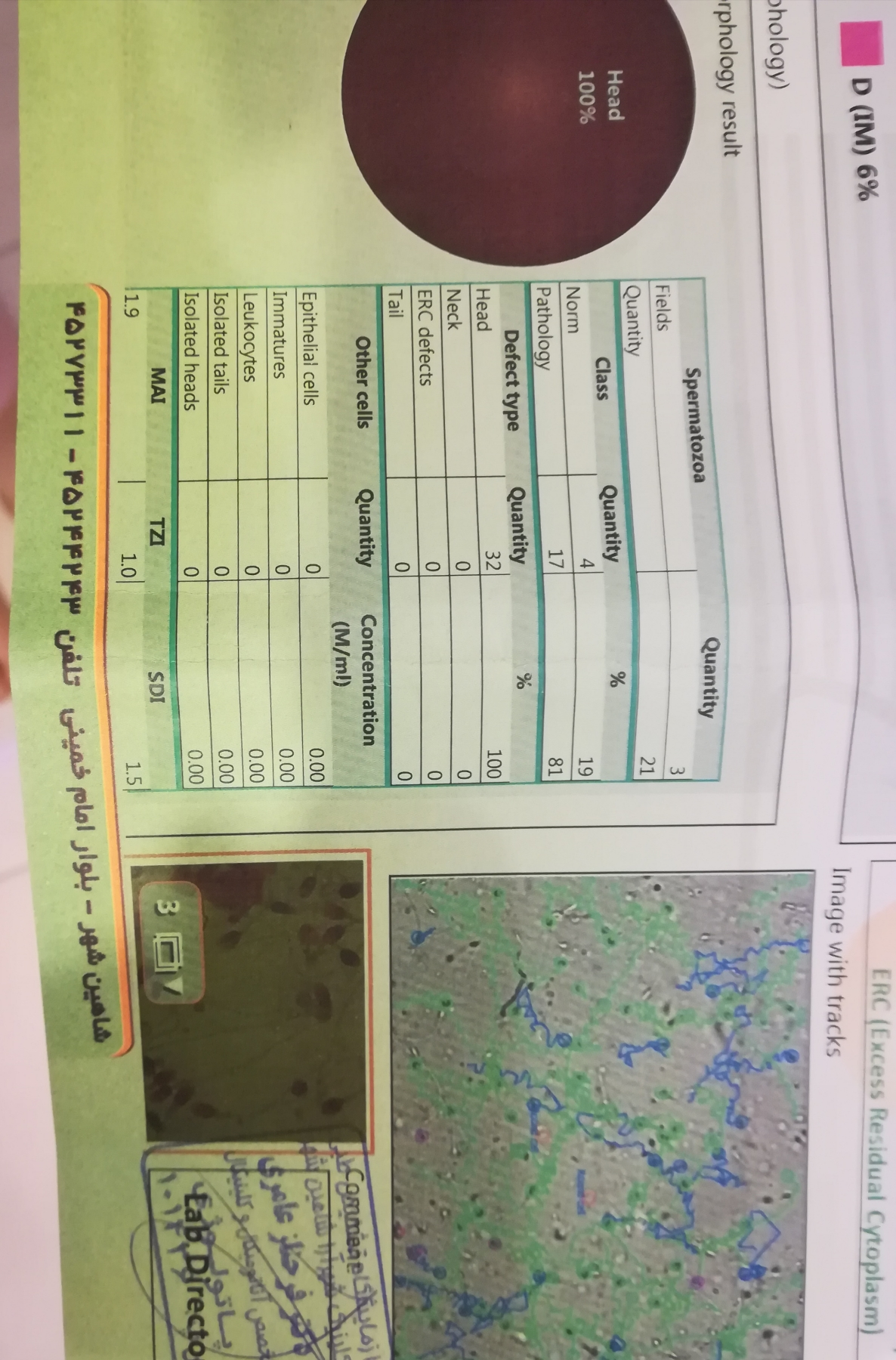 تفسیر ازمایش اسپرم