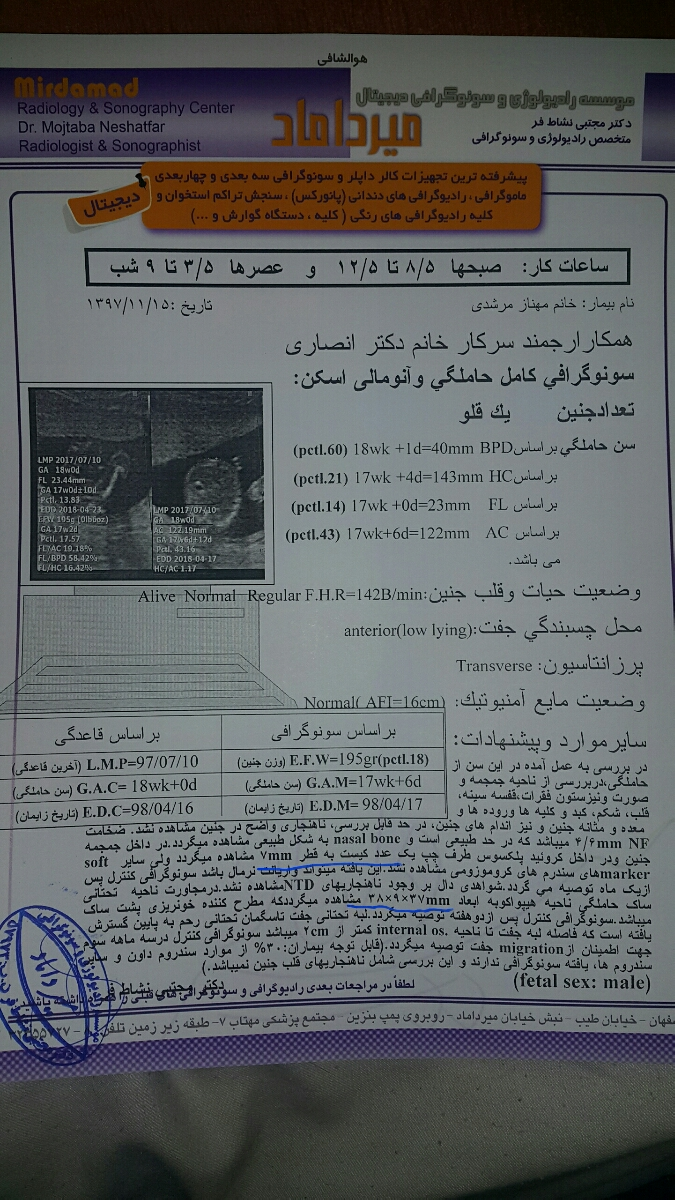 لطفا سونو آنومالی را تفسیر کنید