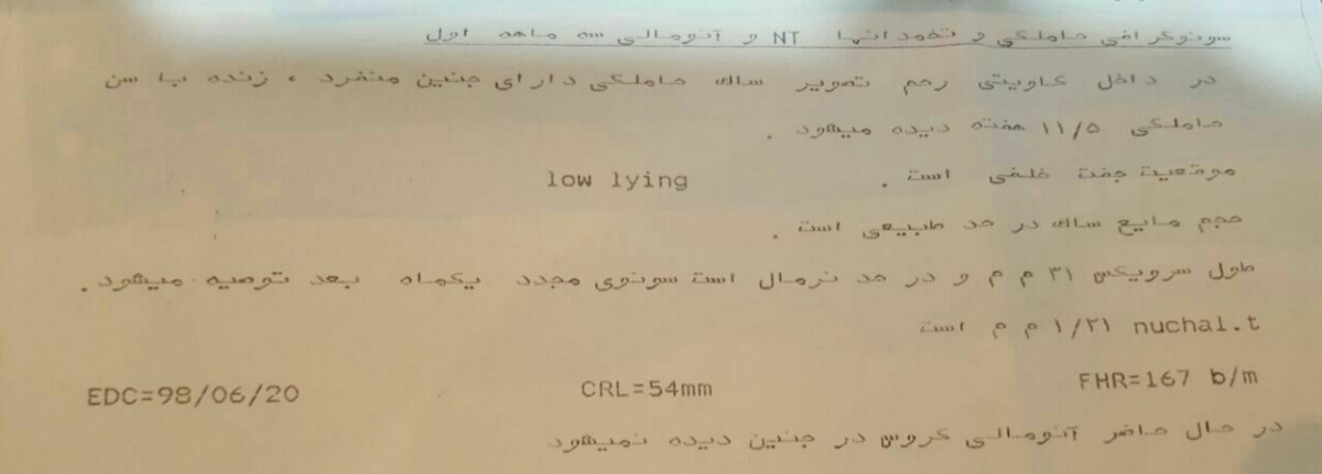 لطفا تفسیر سونوگرافی nt