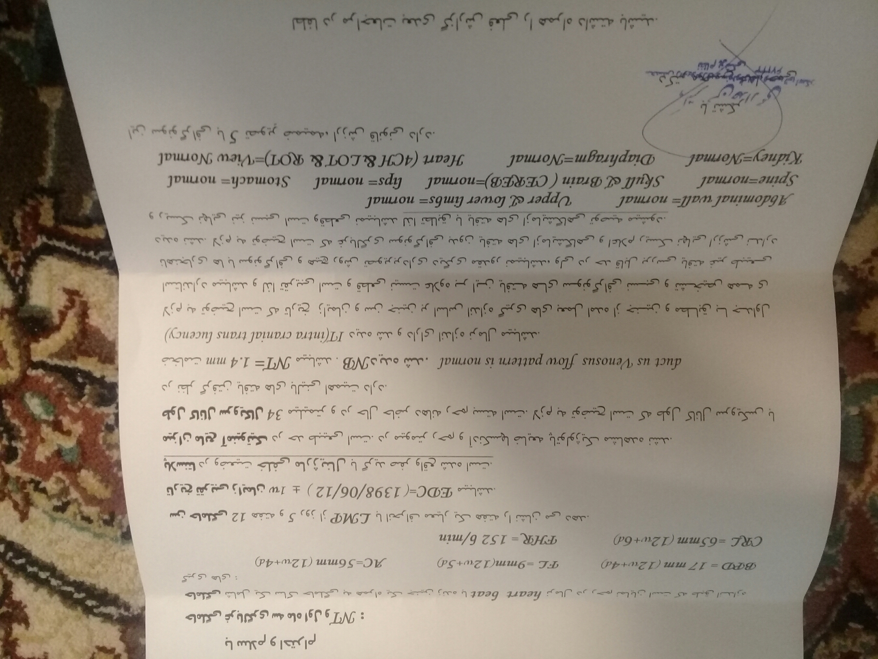 جواب سونو ان تی