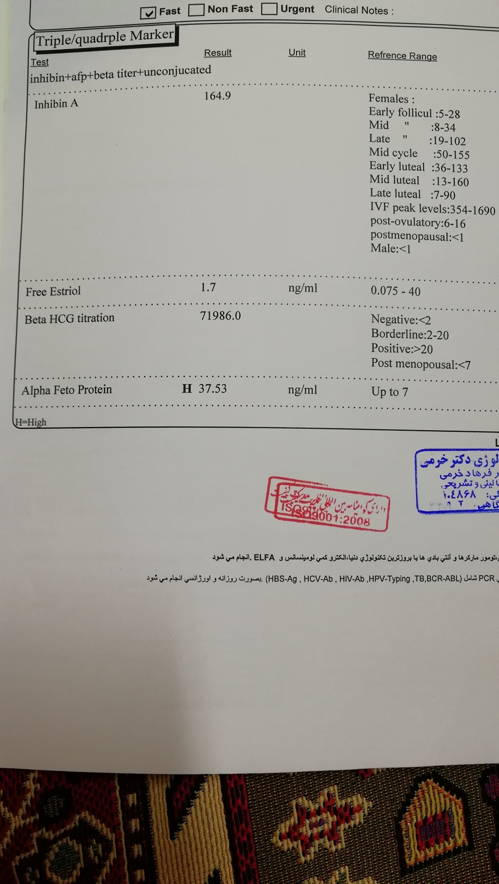 تفسیر جواب آزمایش آنومالی