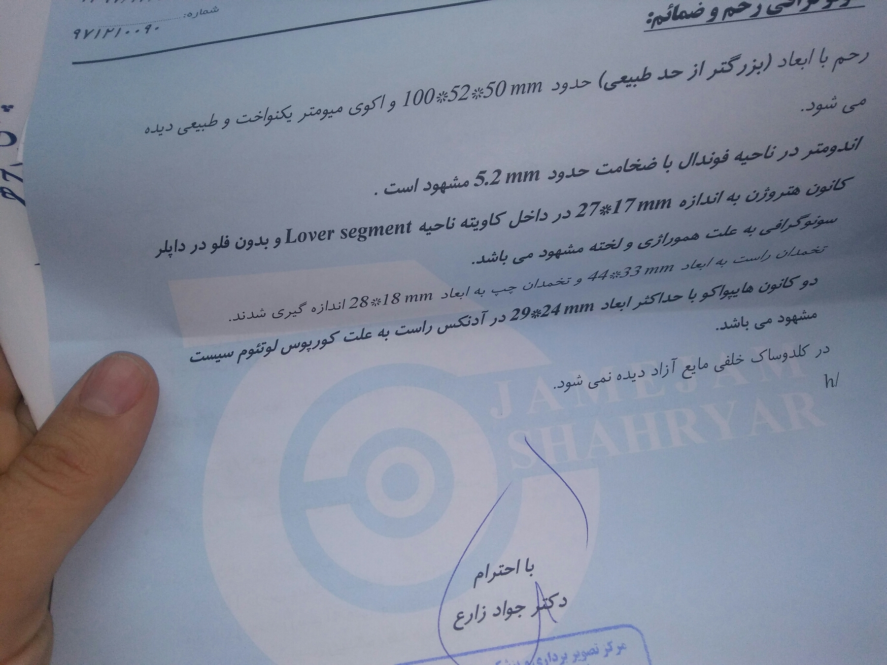 سلام هفت هفته ویک روزباردارم صبح سونودادم جنین سالمه پشت جفت لخته خون هست ازصبح لکه های قهوه؟ایی بوداما الان مثل پریوده،شیاف وآمپول زدم،یعنی خونریزیم قطع میشه انقدنگرانم واسترس دارم همش گریه میکنم سلام هفت هفته ویک روزباردارم صبح سونودادم جنین سالمه پشت جفت لخته خون هست ازصبح لکه های قهوه؟ایی بوداما الان مثل پریوده،شیاف وآمپول زدم،یعنی خونریزیم قطع میشه انقدنگرانم واسترس دارم همش گریه میکنم