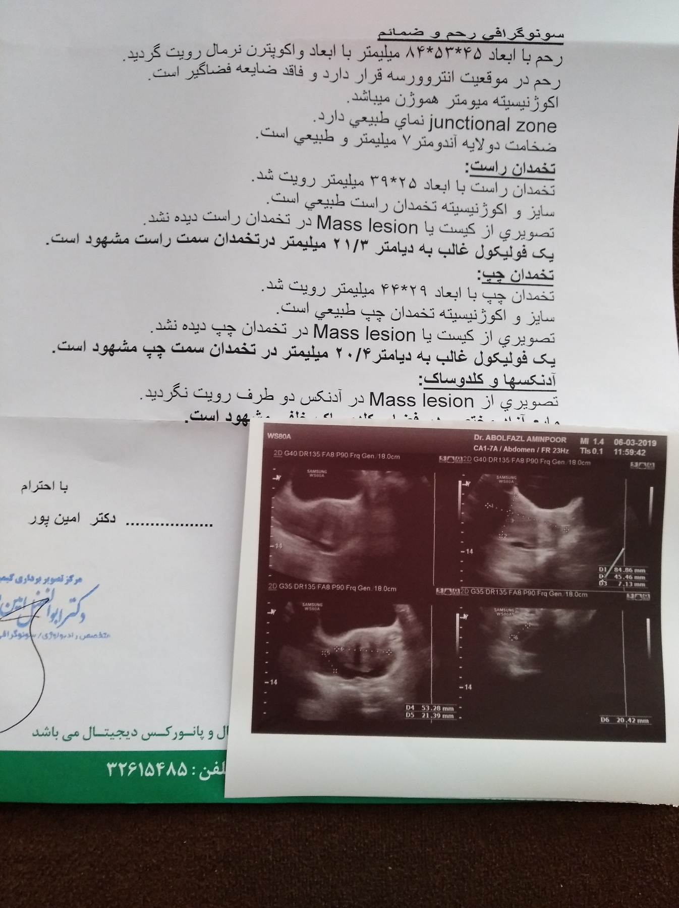 جواب سونو برای فولیکول غالب جواب سونو برای فولیکول غالب