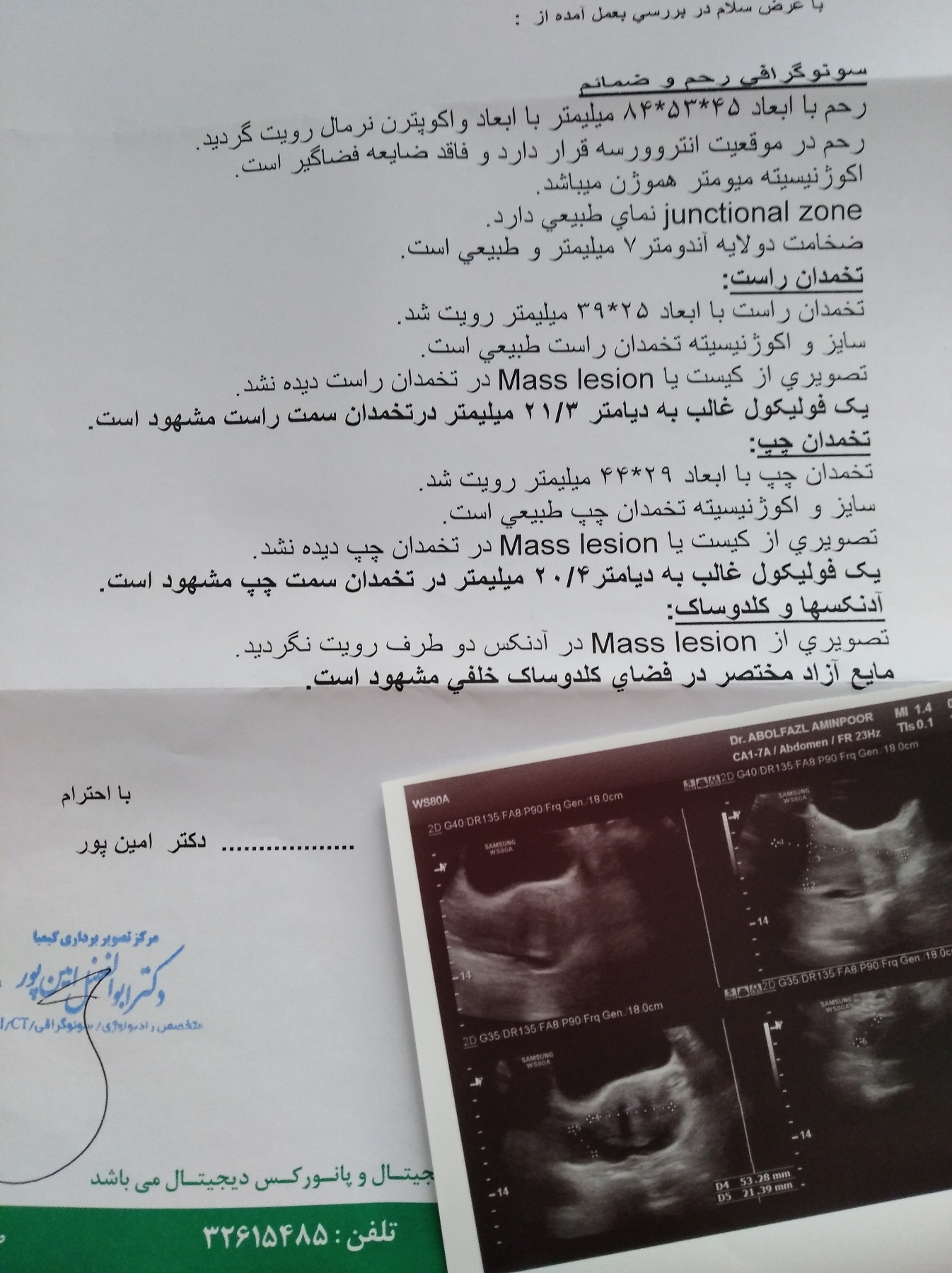 جواب سونو برای فولیکول غالب جواب سونو برای فولیکول غالب