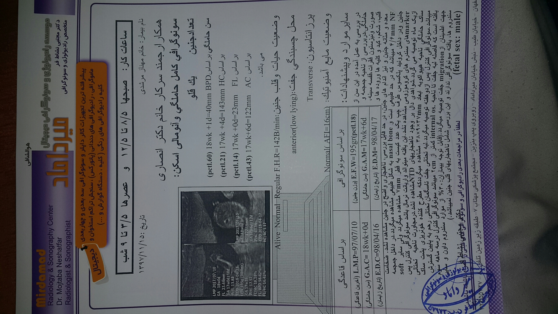 درد شدید کمر و واژن