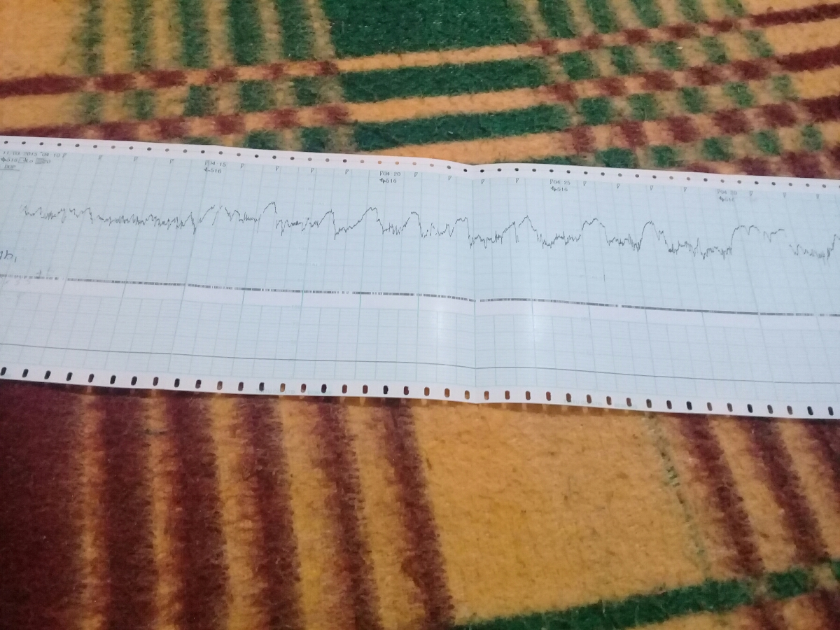 تفسیر نوار قلب جنین