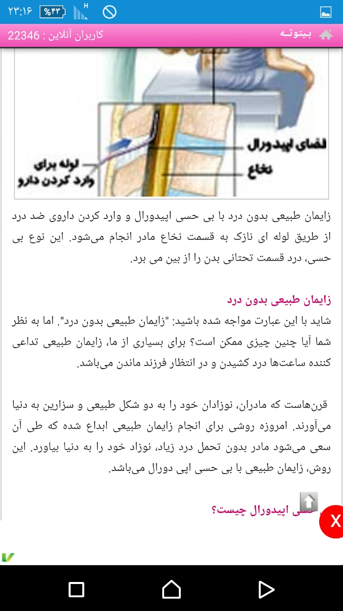 امپول کاهش درد زایمان طبیعی امپول کاهش درد زایمان طبیعی