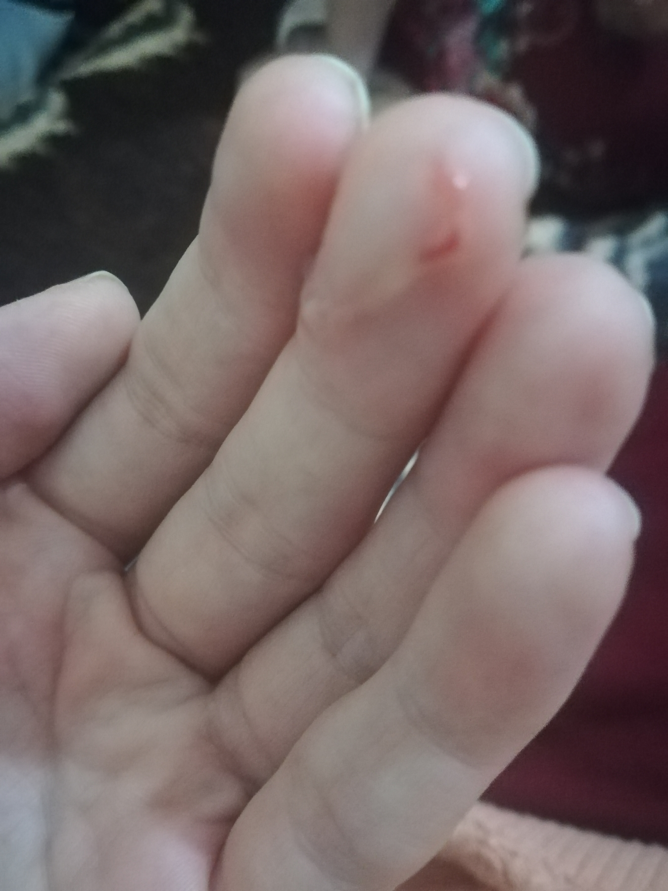 لک بینی بعد از شیاف