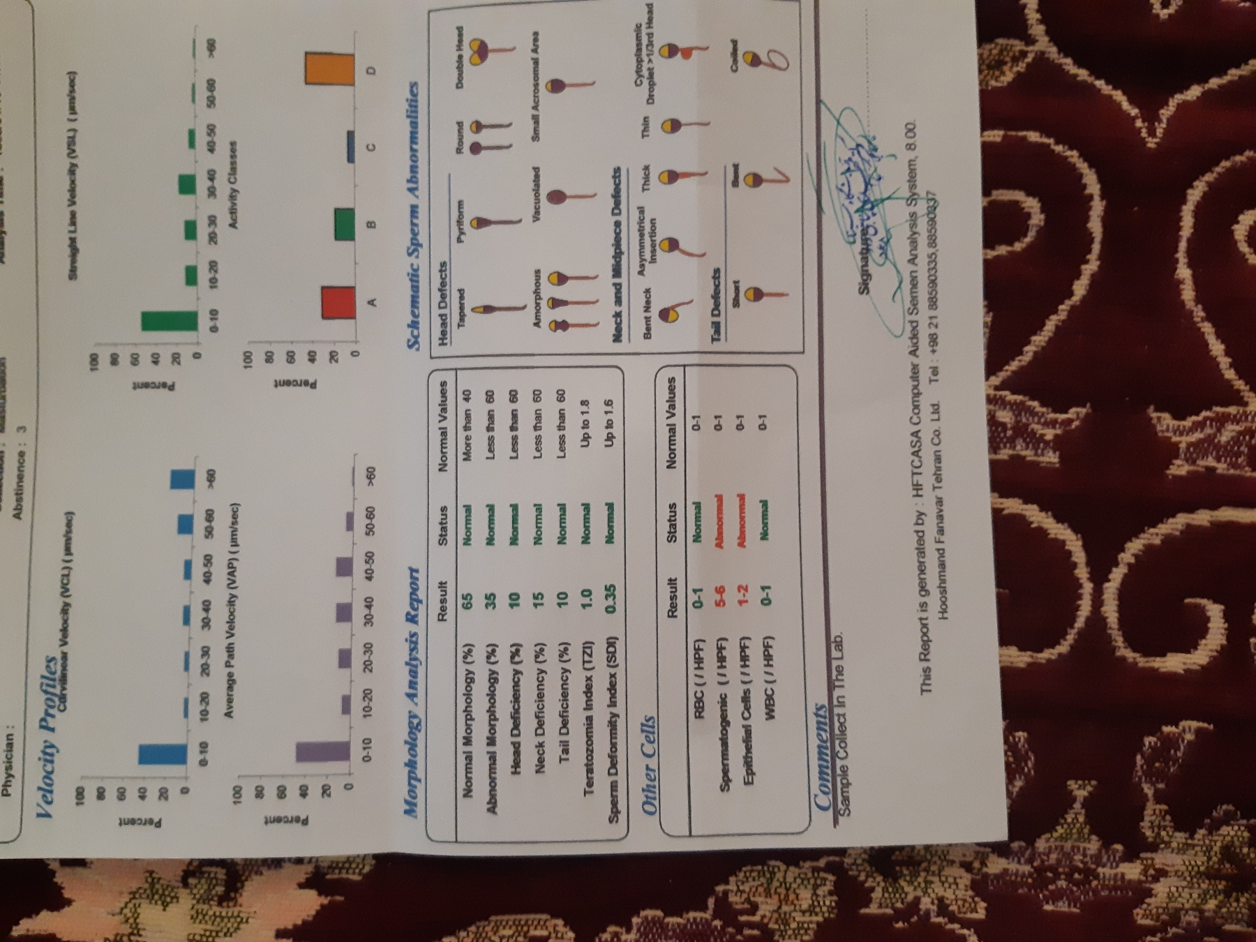 جواب آزمایش اسپرم شوهرم