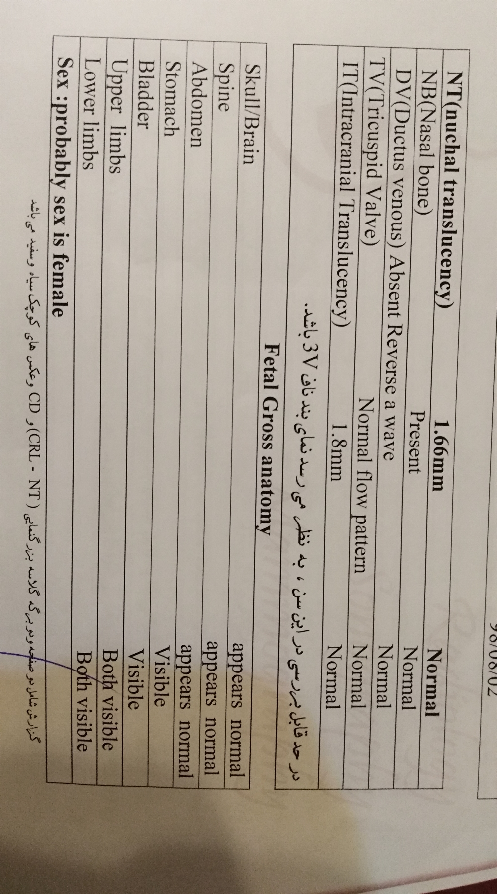 آزمایش غربالگری اول (nt)