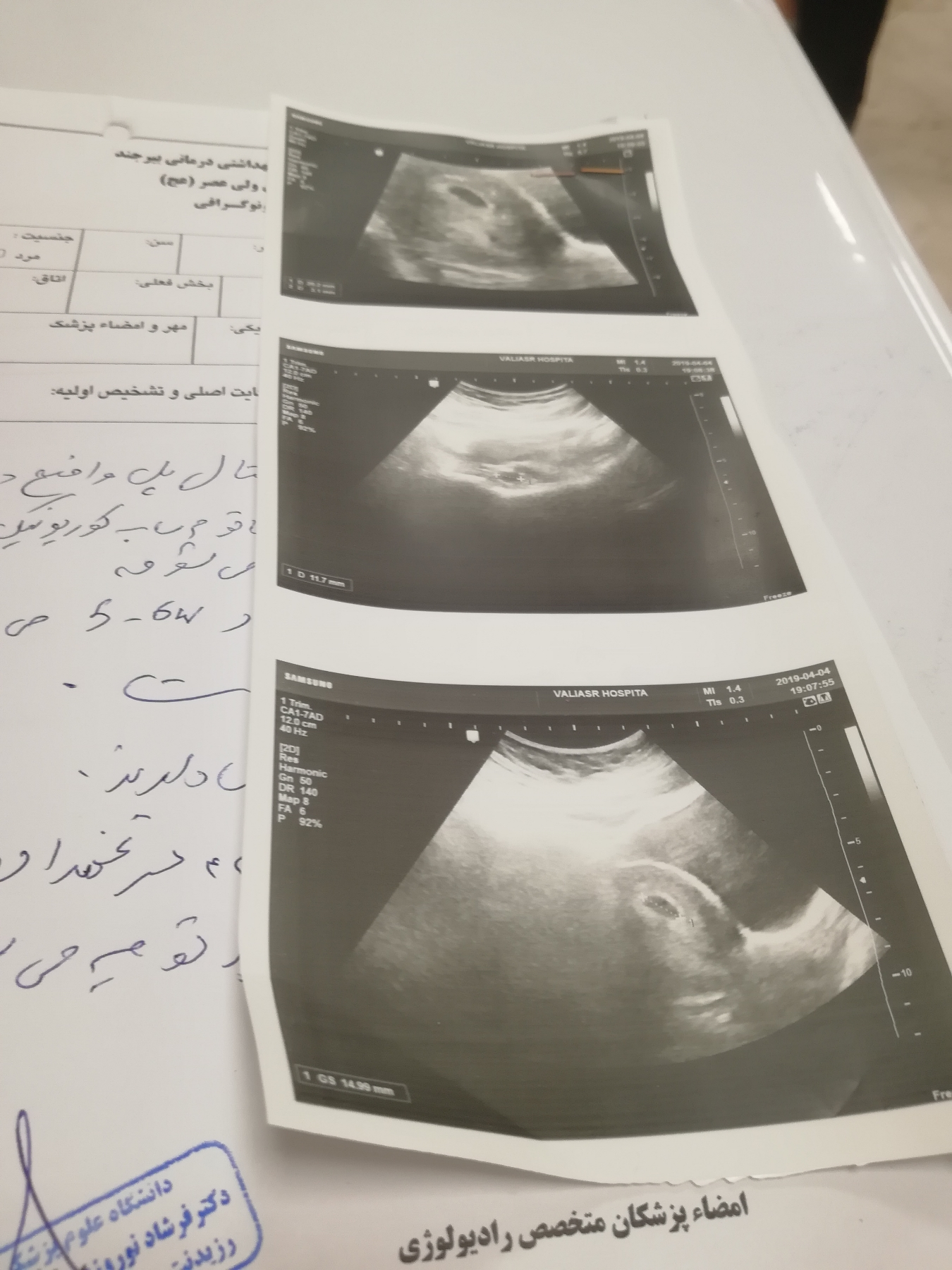 عدد بتا رو بگو بگم پسره دختر عدد بتا رو بگو بگم پسره دختر