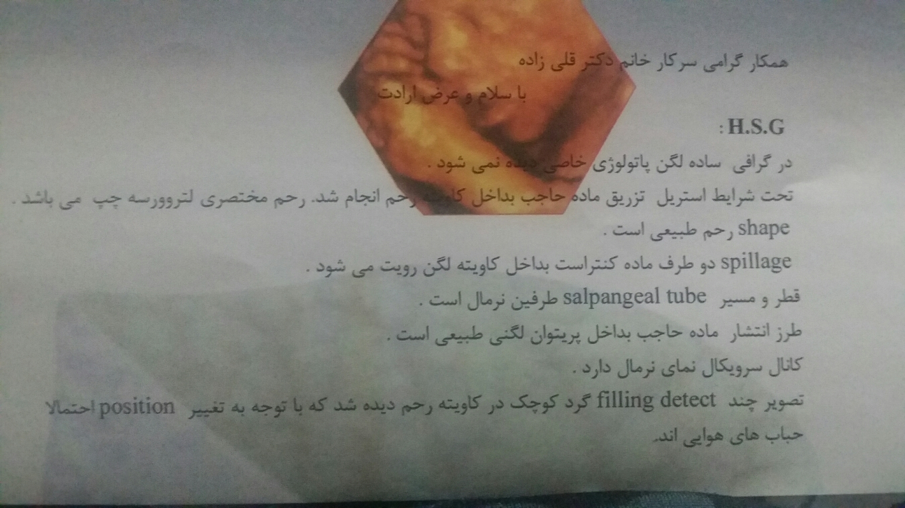 عکس رنگی رحم و تخمدان