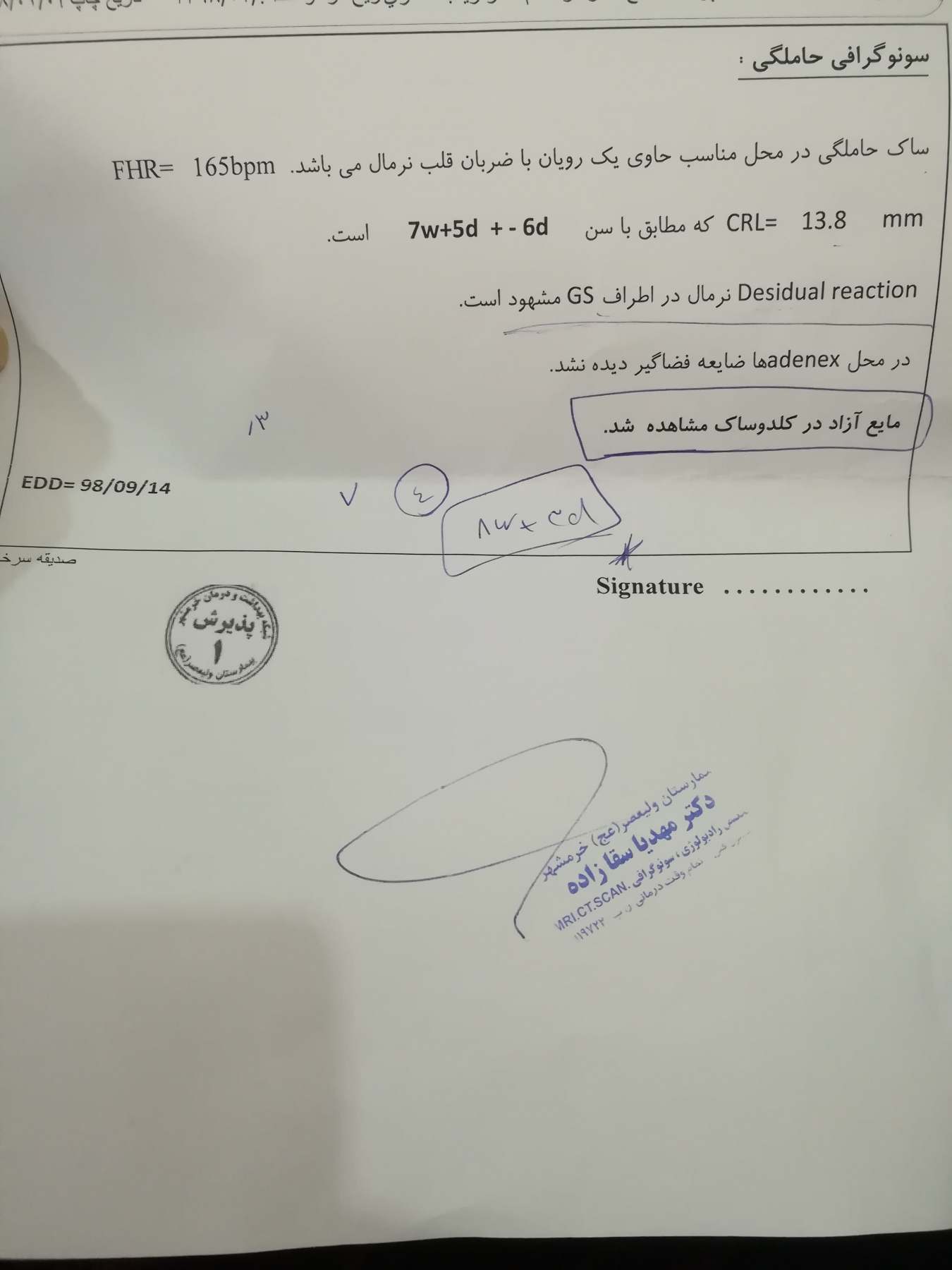 مایع ازاد در کلدوساک مایع ازاد در کلدوساک