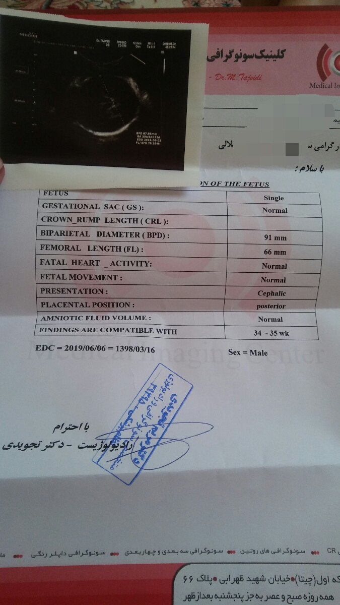 سونو گرافی 36 هفتگی سونو گرافی 36 هفتگی