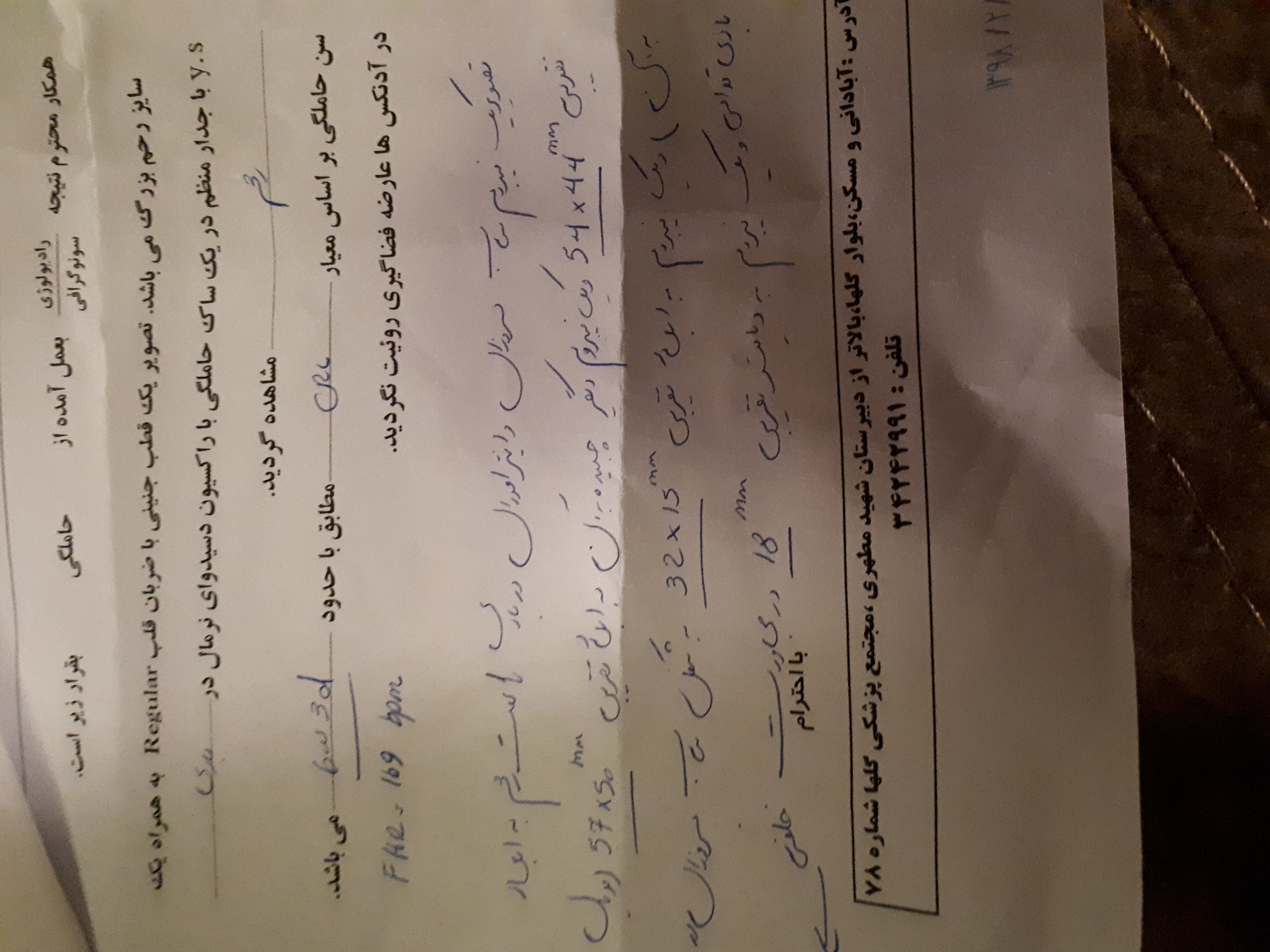 خطر فیبروم در بارداری
