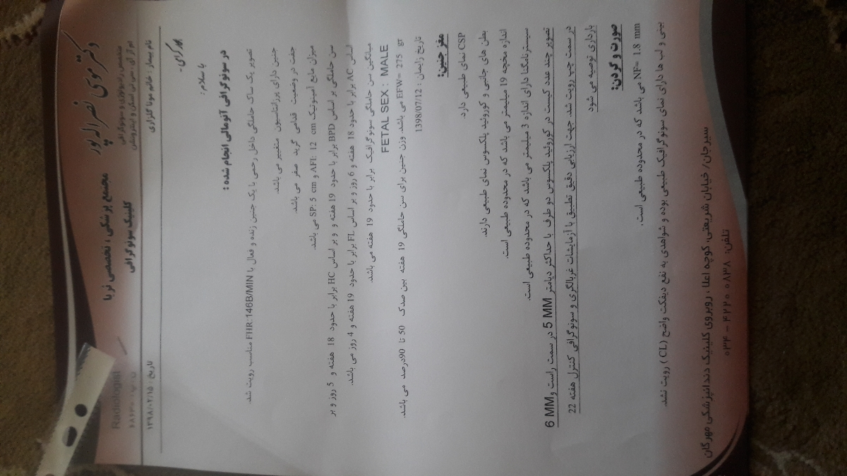 کیست در کورویید پلکسوس کیست در کورویید پلکسوس