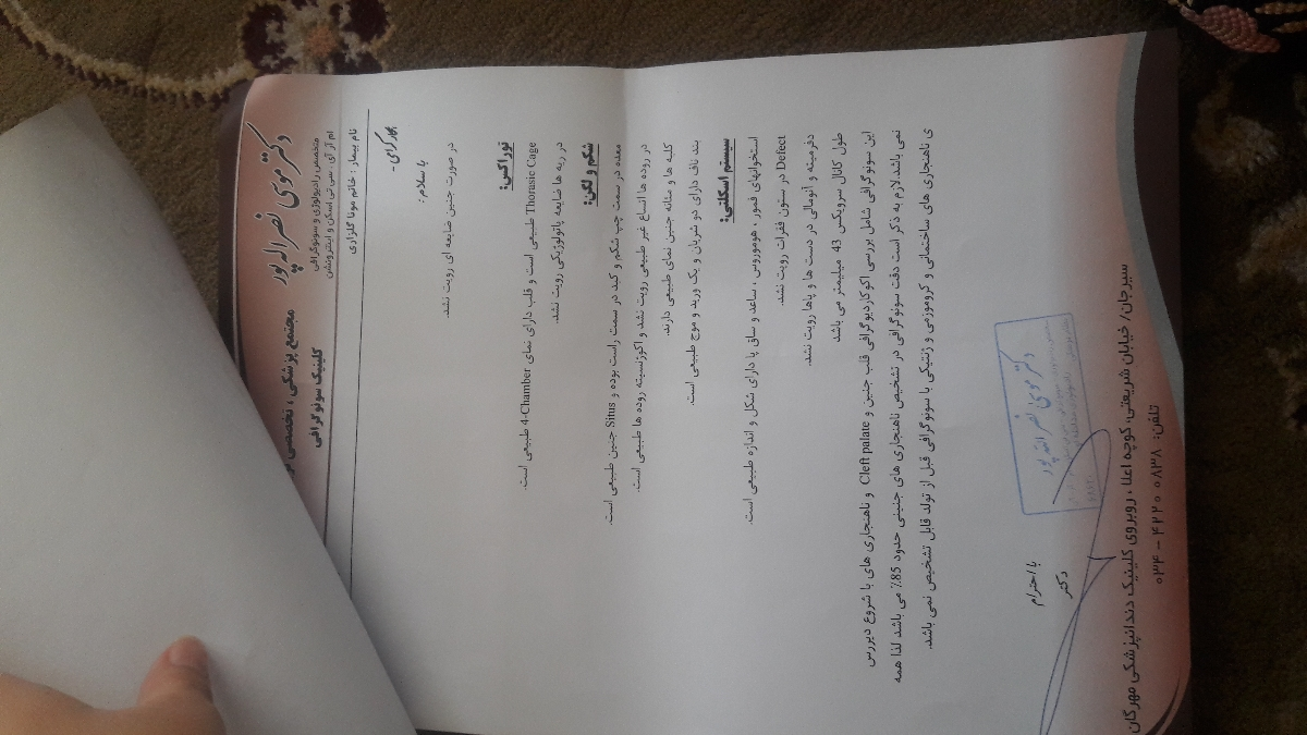 کیست در کورویید پلکسوس کیست در کورویید پلکسوس