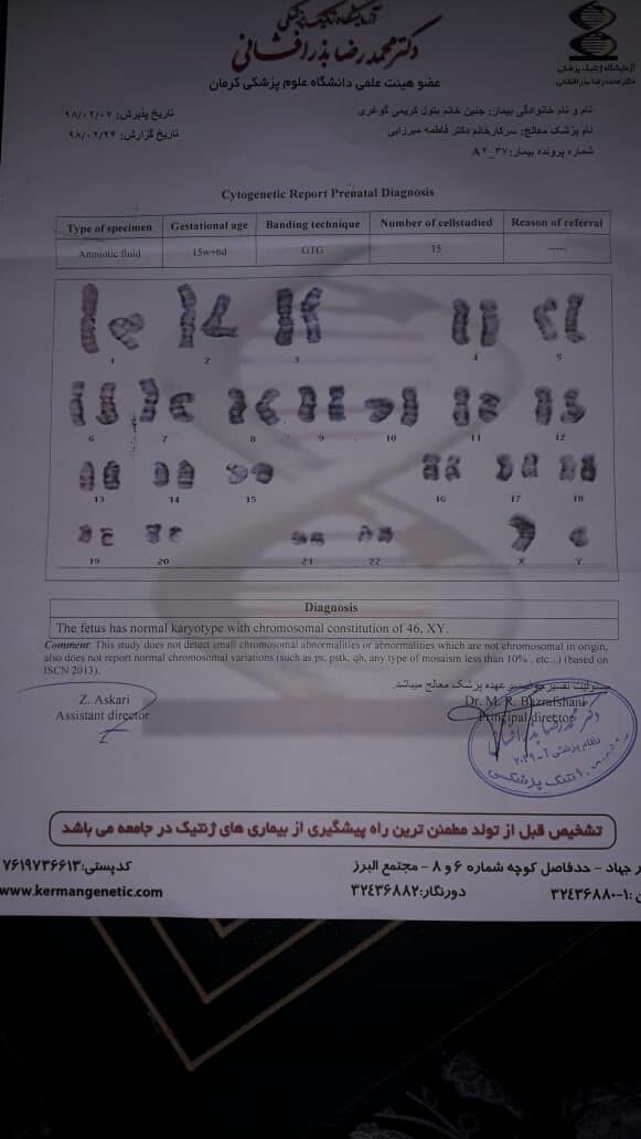 ازمایش امینوسنتز واسه سندر داون ازمایش امینوسنتز واسه سندر داون