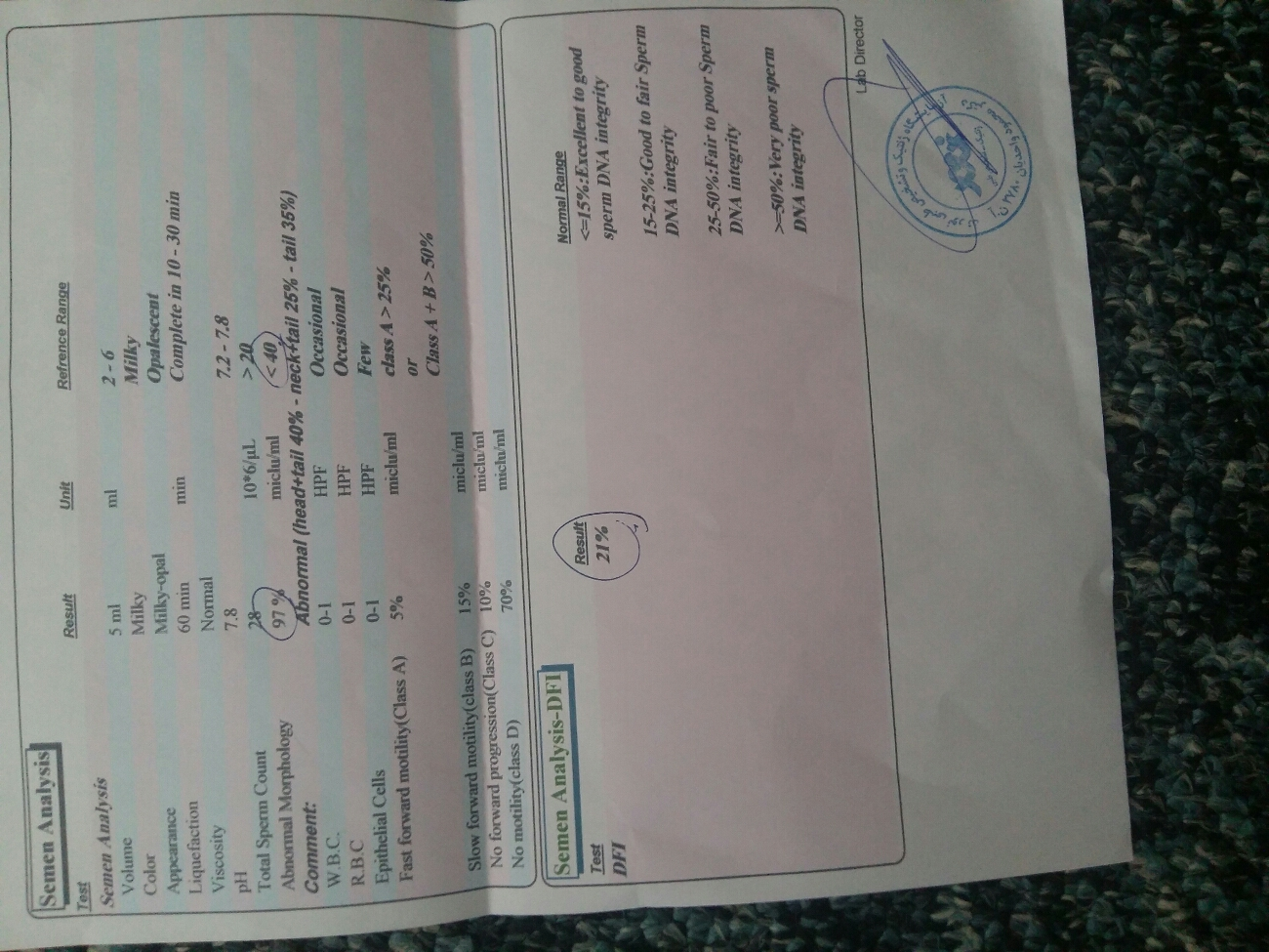 آزمایش اسپرم همسر آزمایش اسپرم همسر