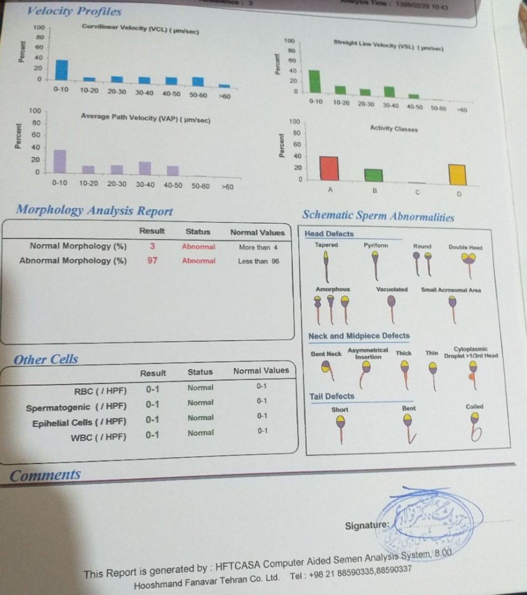 تفسیر آزمایش اسپرم