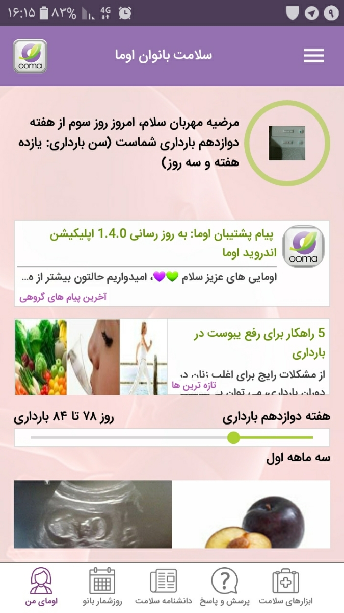 غربالگری و سونوگرافی ان تی سه ماهه اول غربالگری و سونوگرافی ان تی سه ماهه اول