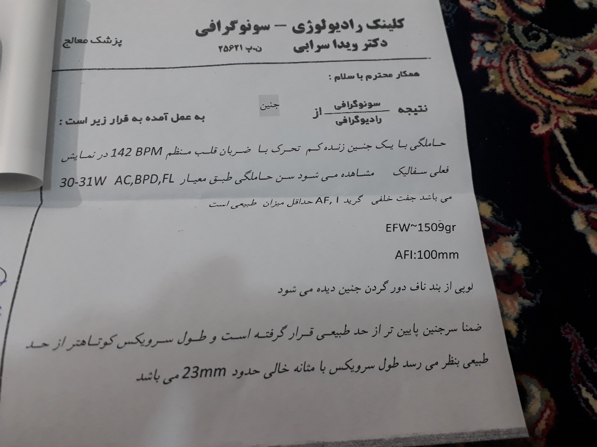 زایمان زود رس