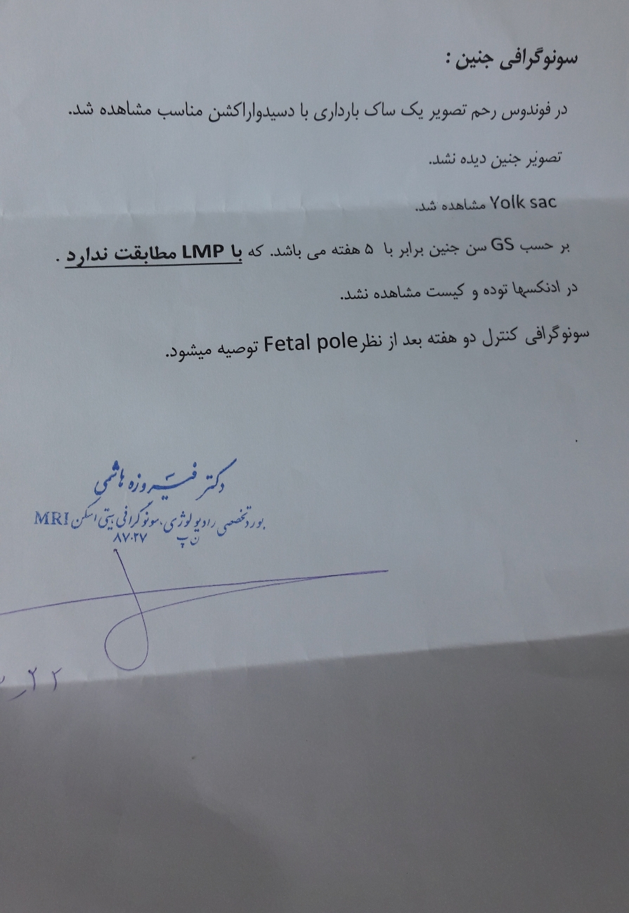 بتای کسی ۵۵ بوده؟