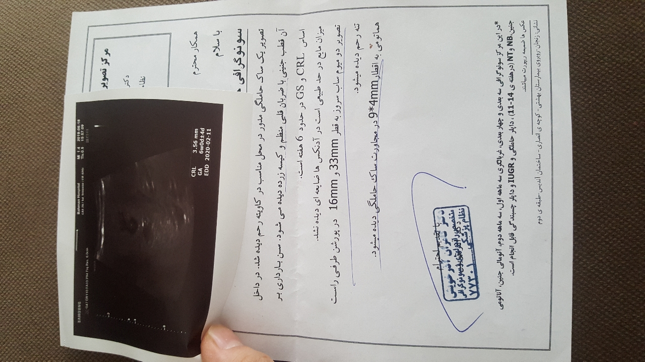 لکه بینی در هفته ۶ بارداری لکه بینی در هفته ۶ بارداری