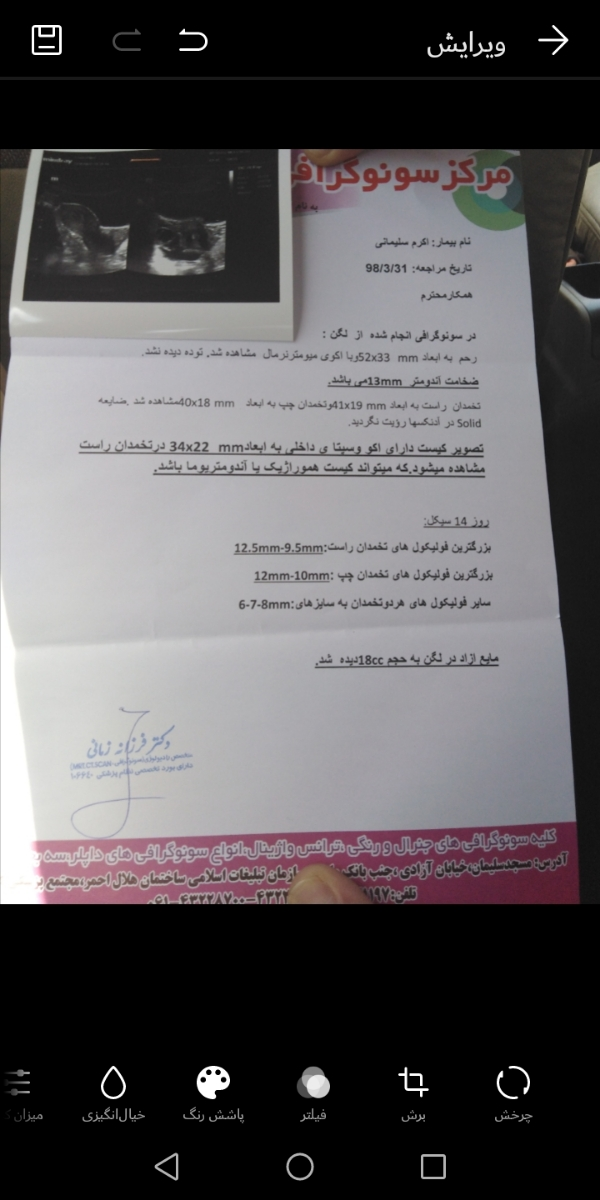 سونو گرافی روز 14سیکل،
توروخدا یه جوابی بهم بدید دارم دیوونه میشم😔