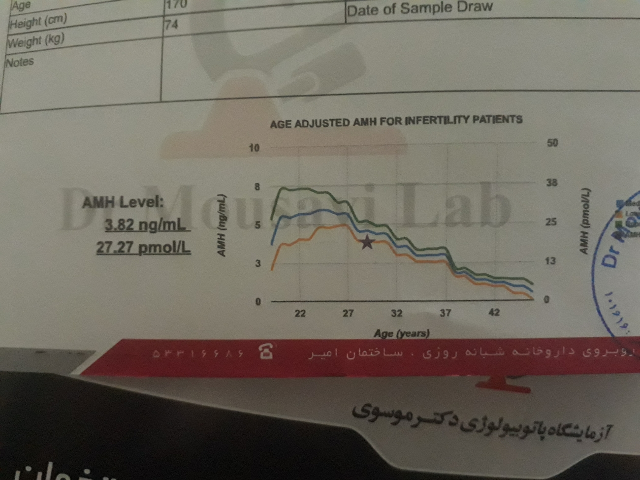 ازمایش ذخیره تخمدان و fsh بالا