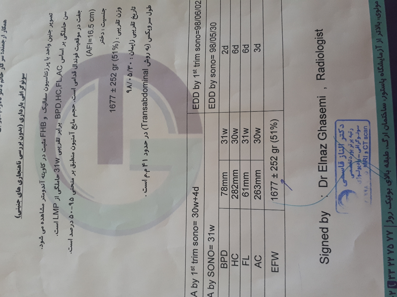 تفسیر سنوگرافی وزن