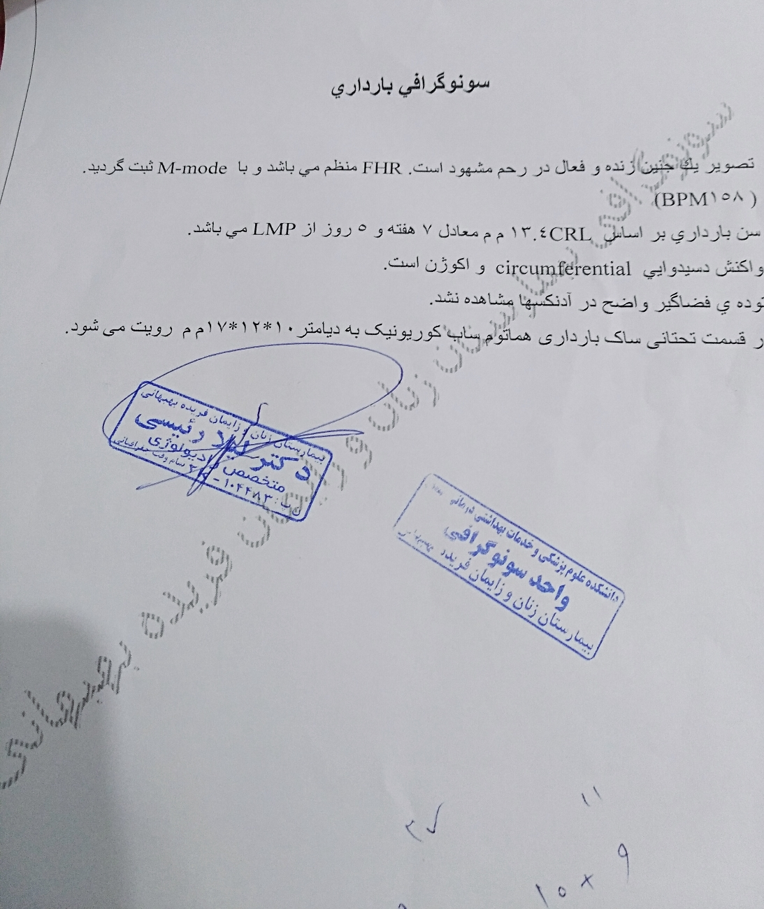هماتوم در هفته ۸ هماتوم در هفته ۸
