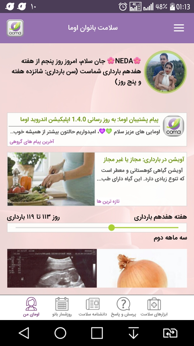 رفتن برای سونوی انومالی