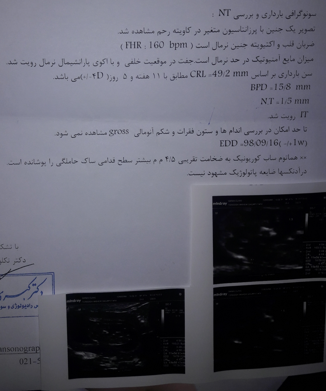 it در غربالگری اول؟