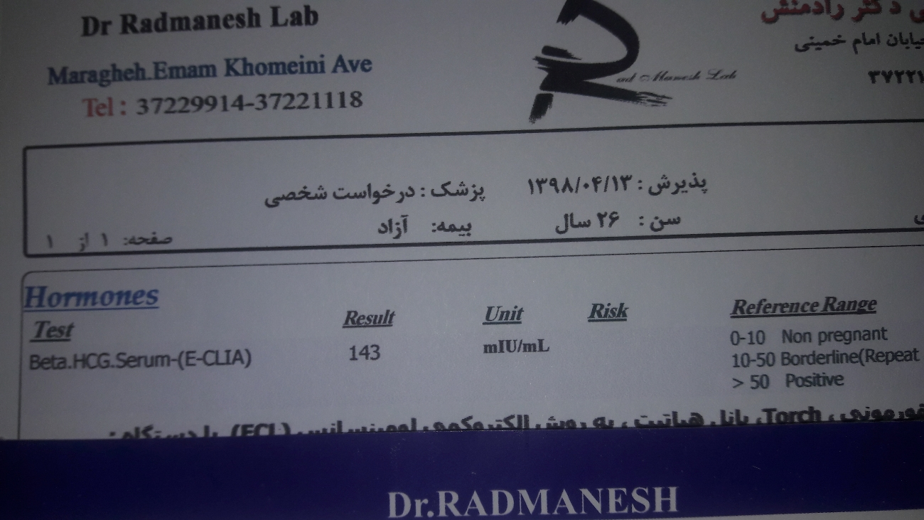 هاله انداختن بی بی چک و پررنگ نشدن