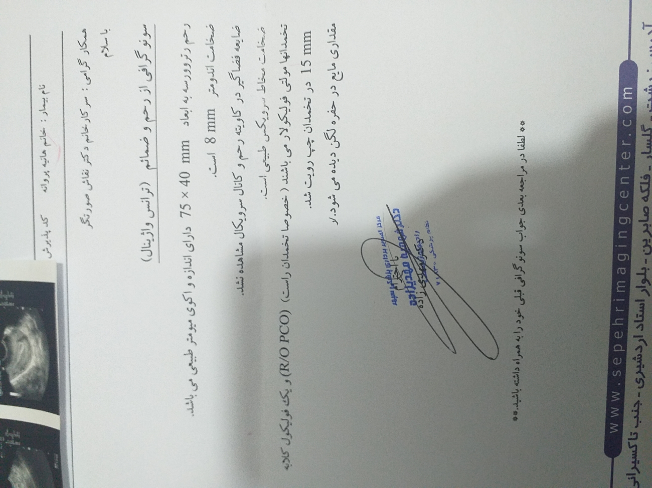 تست تخمکگذاری قبل بارداری