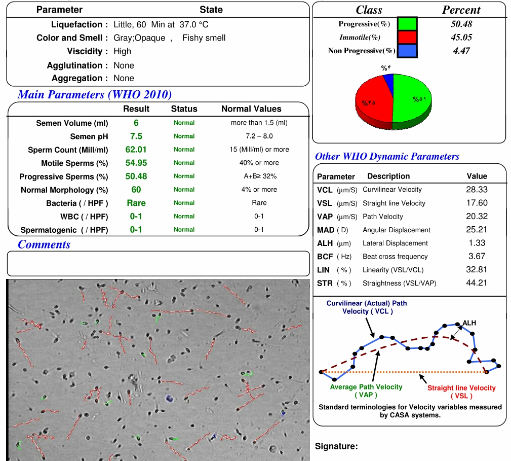 تفسیر ازمایش اسپرموگرام ..