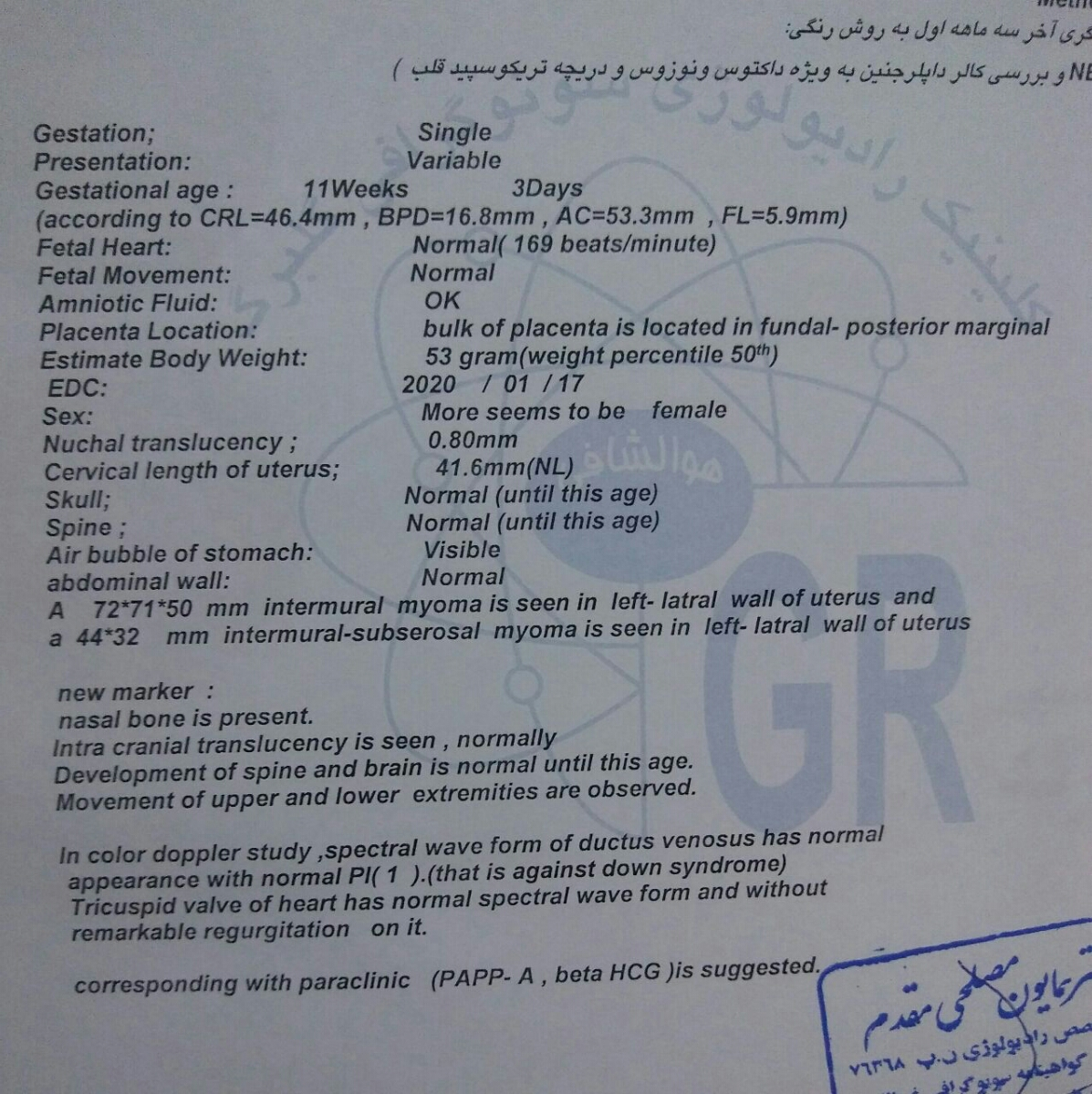تفسیر سونو وعدد nt