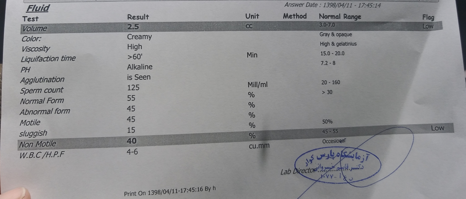 تفسیر آزمایش اسپرم