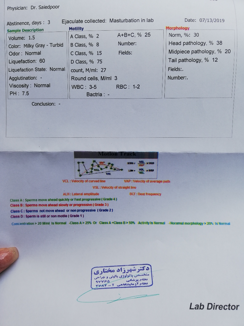 تفسیر آزمایش semen(اسپرم)
