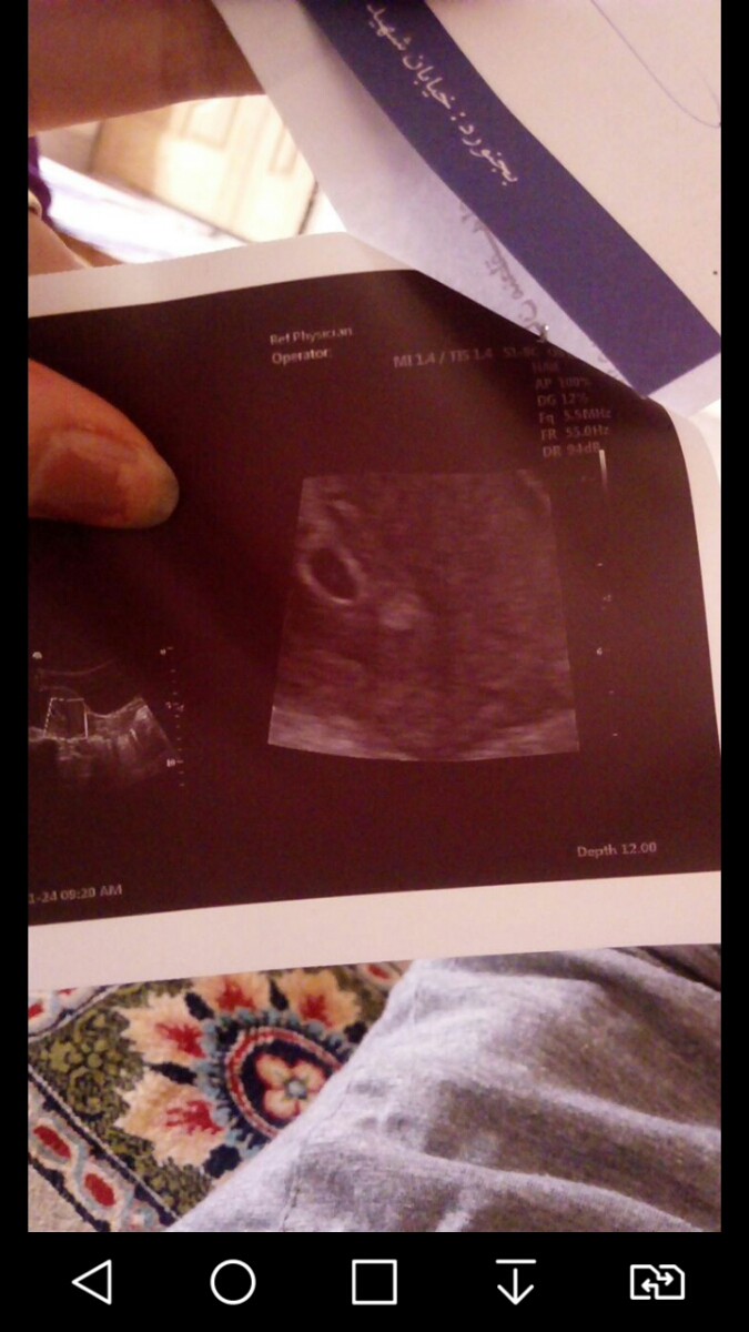 Yolk sac چه معنی داره Yolk sac چه معنی داره