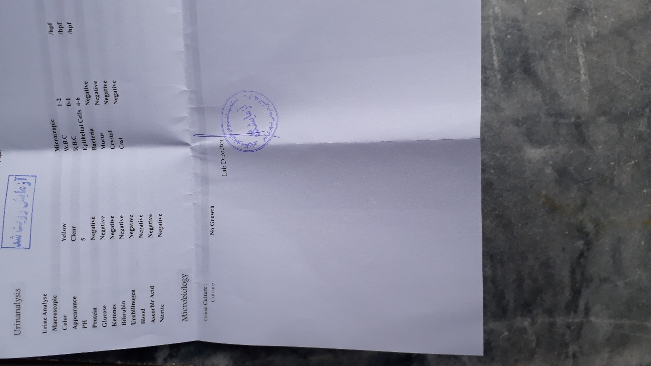 آزمایش کلیات منو چک میکنید خانم دکتر