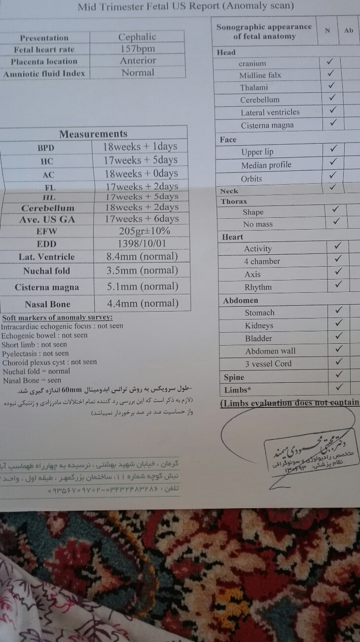 سلام سونو انومالی منو تفسیر کنید