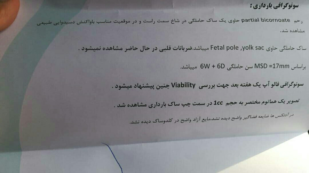 خونریزی و دفع لخته در ۶هفته بارداری خونریزی و دفع لخته در ۶هفته بارداری