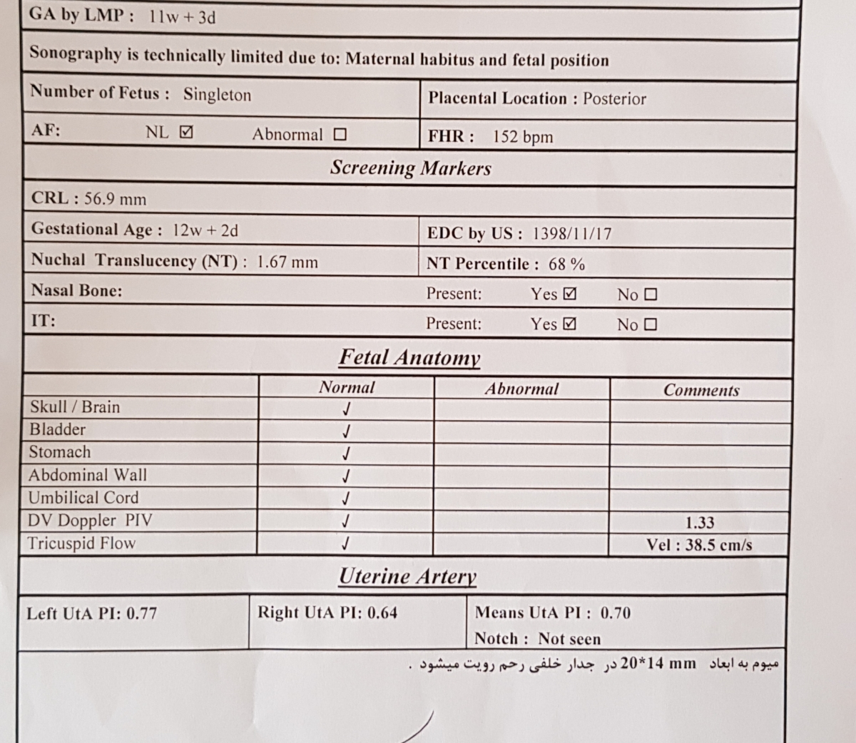 نتیجه غربالگری ۱۲ هفته