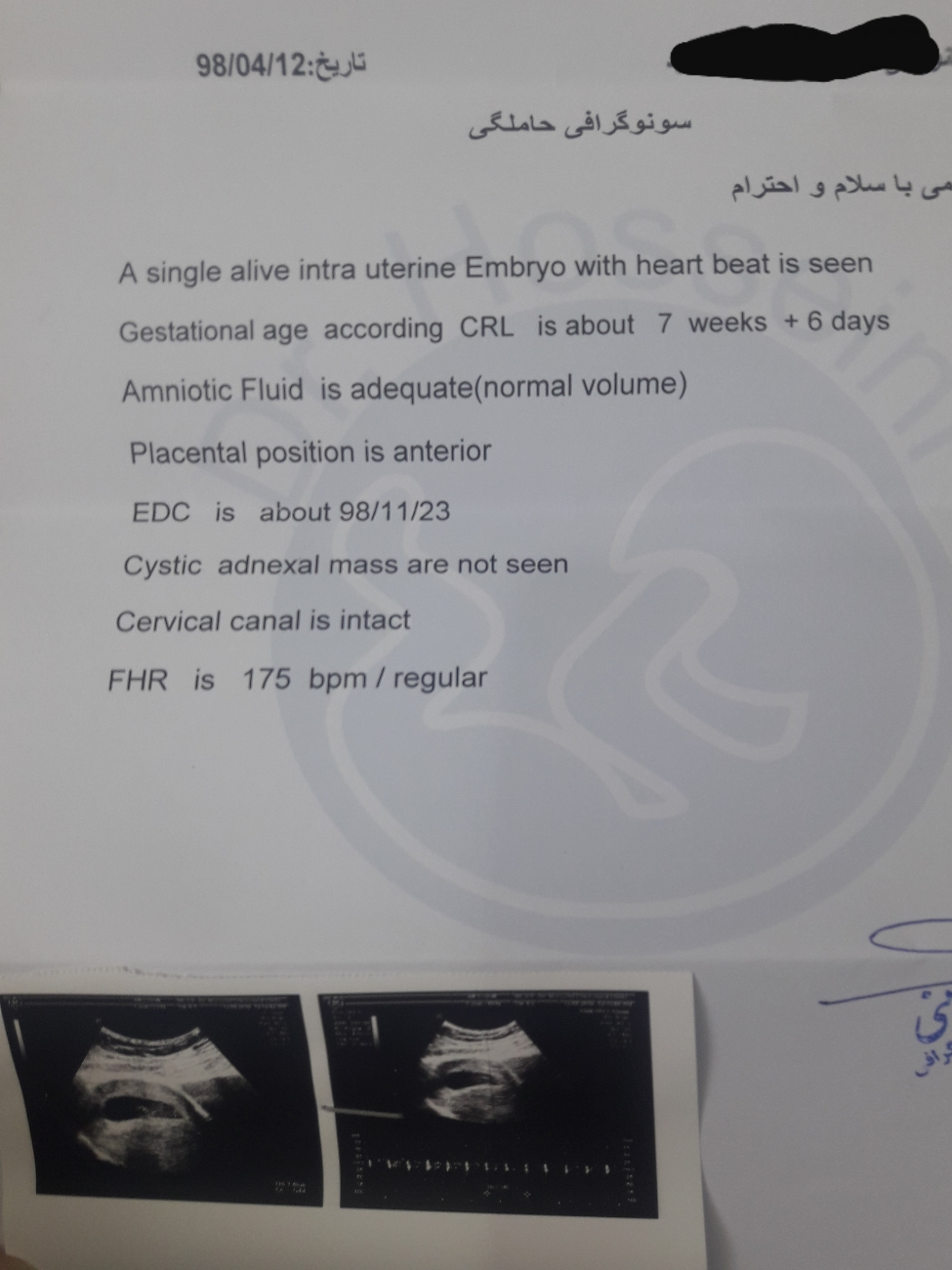 خانم‌ دکتر هفته چندم هستم